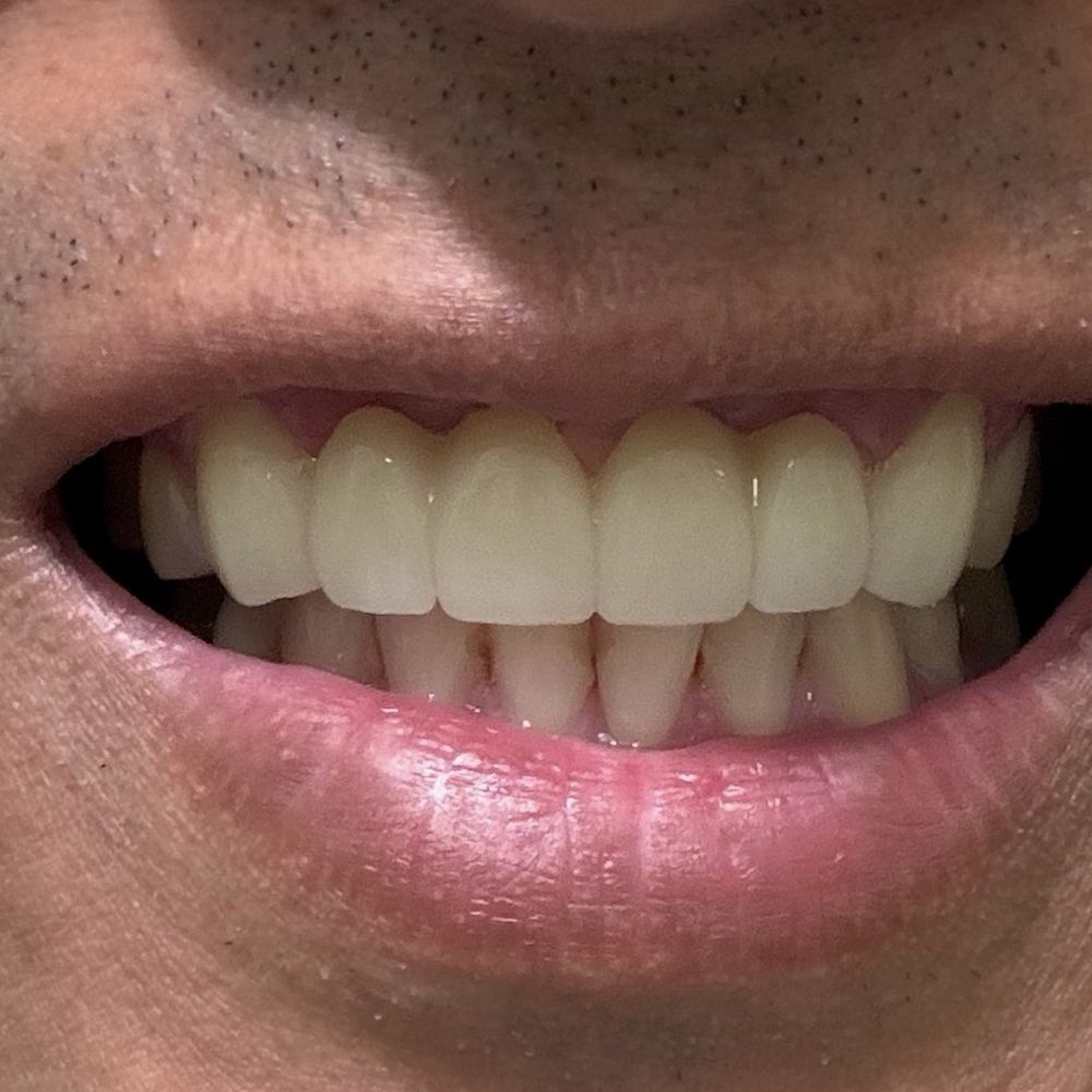 Cedar Smiles Dentistry - the new one - General Dentistry Near Me - Bellflower, California