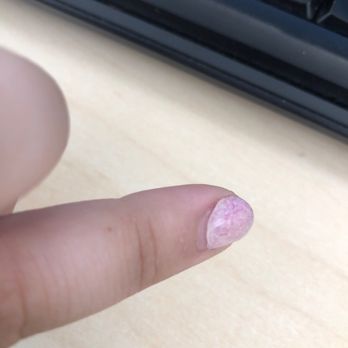 The Nail Lounge - it started peeling on my left nail bed where you can see the lady who did them got the gel too far and on my actual finger. - Nail Salons Near Me - Moore, Oklahoma