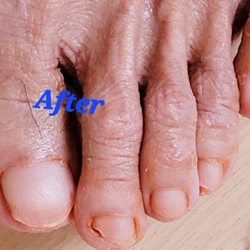 Ostomy & Wound Education Academy - After mobile medical foot and nail care