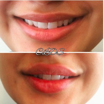 Cosmetic & Laser Dental Studio - Cosmetic Dentists Near Me - Brooklyn, New York Cosmetic & Laser Dental Studio - Cosmetic Dentists Near Me - Brooklyn, New York