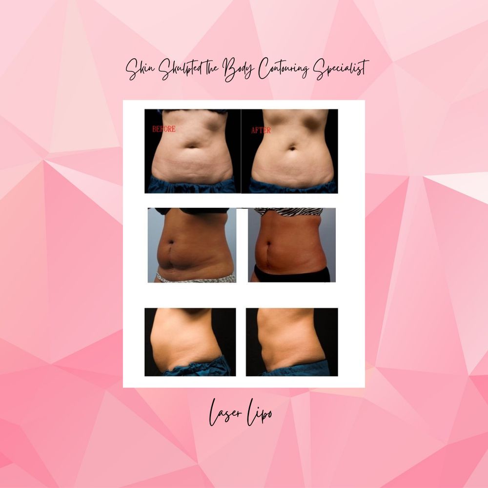 SKULPTED SKIN THE BODY CONTOURING SPECIALLIST 2201 Double Creek
