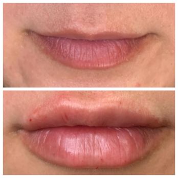 Quinn Aesthetics - Skin Care Near Me - Riverside, California Quinn Aesthetics - Skin Care Near Me - Riverside, California