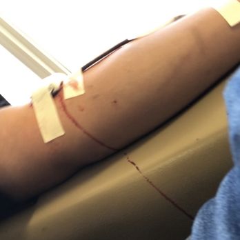 Octapharma Plasma 10 Photos Blood Plasma Donation Centers 2588 Hubbell Ave Des Moines Ia Phone Number