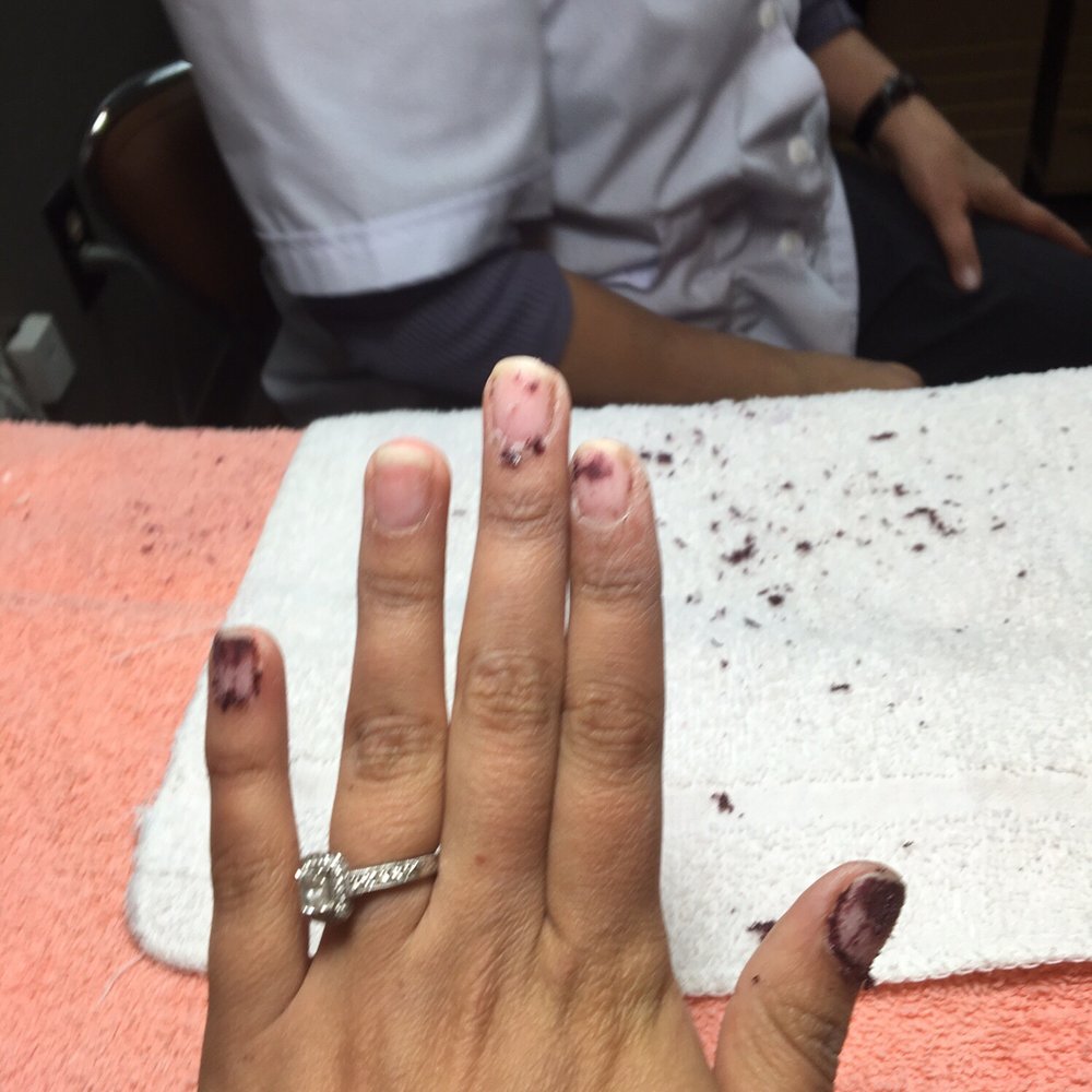 Parkview Nails - This is how she left my nails before she decided that she wasn't going to do them and that she had to go home. - Nail Salons Near Me - Houston, Texas Parkview Nails - This is how she left my nails before she decided that she wasn't going to do them and that she had to go home. - Nail Salons Near Me - Houston, Texas