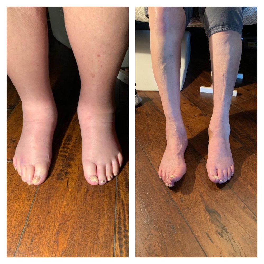 LaLaLand Lymphatics Logo