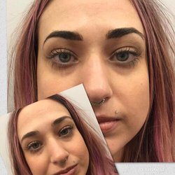 Phyllis Scherer - Before and immediately after permanent eyebrows.