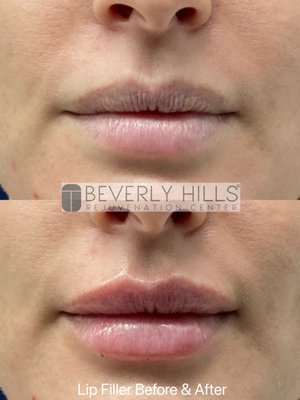 Beverly Hills Rejuvenation Center Westlake Village by null