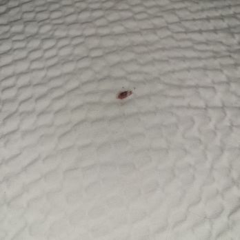 Comfort Inn Ruther Glen Near Kings Dominion - Blood stain on bed - Hotels Near Me - Ruther Glen, Virginia Comfort Inn Ruther Glen Near Kings Dominion - Blood stain on bed - Hotels Near Me - Ruther Glen, Virginia