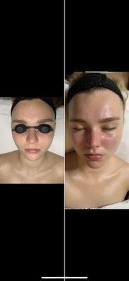 Buttercup Skin Care by null