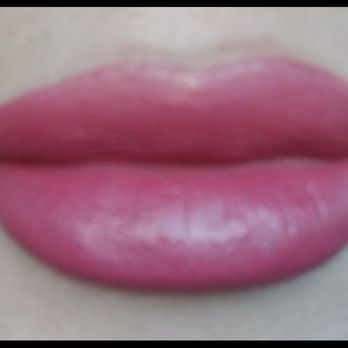 Anew Laser, MD - My lips after - Medical Spas Near Me - El Monte, California