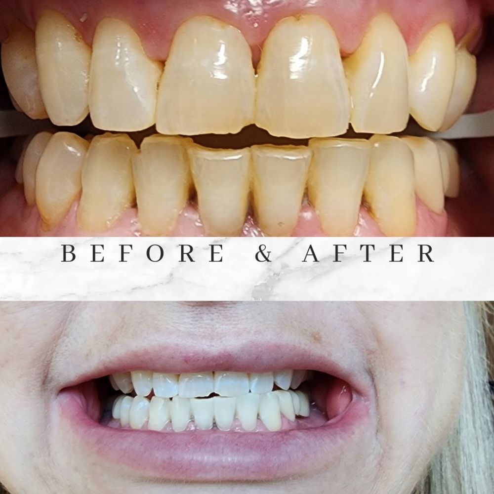 DIAMOND SMILES BY MELINDA Updated April 2024 Request an Appointment 938 W Page Ave, Dallas