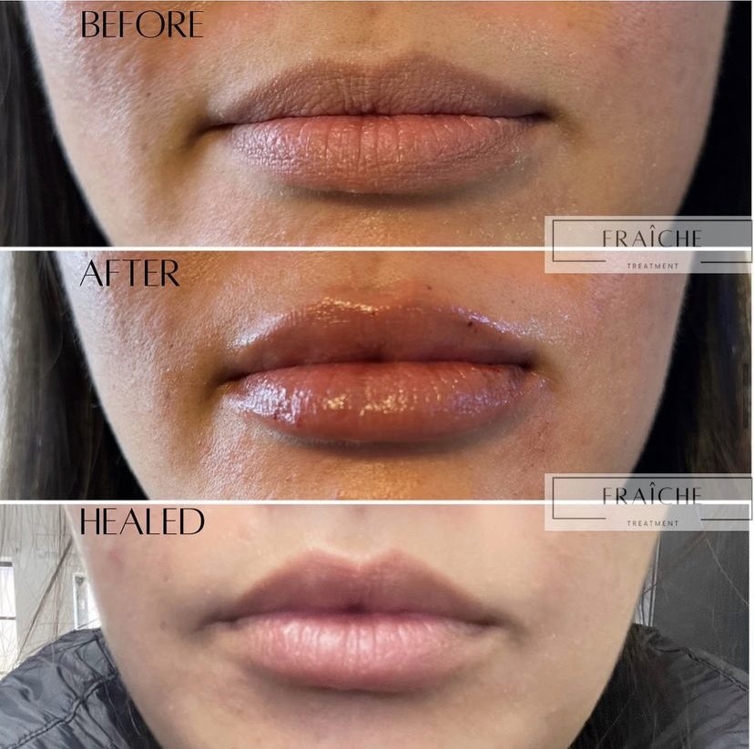 Fraiche Treatment Logo