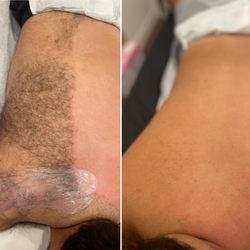 SIN.D.SMOOTH - Six months of monthly waxing