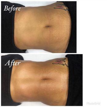 Bea Fabulous - Manual lymphatic drainage - Estheticians Near Me Bea Fabulous - Manual lymphatic drainage - Estheticians Near Me