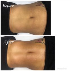 Bea Fabulous - Manual lymphatic drainage