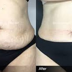 Zul Body Sculpting