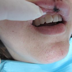 Aaron Payne, DDS - Accidents Happen......
