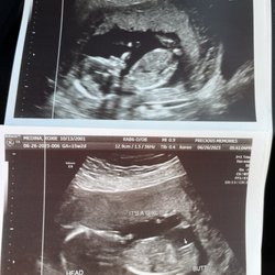 Precious Memories 3D/4D/HD Ultrasound Imaging