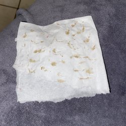 The pore extraction  painful but satisfying, and afterwards my face is bumpless and purified!