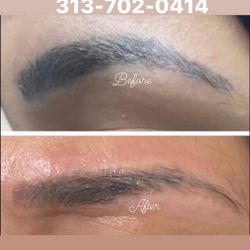 Zeiva Professional Center - Tattoo removal