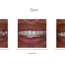 Elite Dental