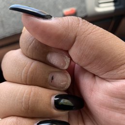 Poorly done nails Poorly done nails