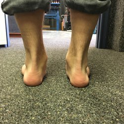 Flat Feet and Plantar Fasciitis are some of the most common things that we see in our clinic.