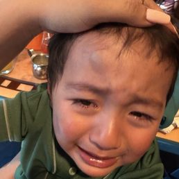 The bump on his head after he fell. The bump on his head after he fell.