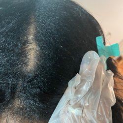 NHCG Trichology - Hair Restoration and Wellness Center - Found out the root cause and now she's preferring a sustainable solution.