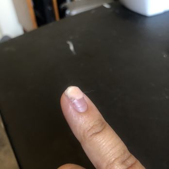 Jojo Nails - My pinky acrylic nail stuck and impossible to remove unless I remove my real nail as well - Nail Salons Near Me - Glendora, California