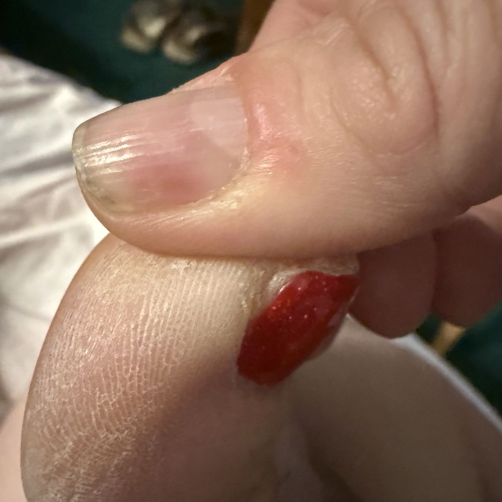 A2Z Nails - Dry skin and not enough polish. - Nail Salons Near Me - Harrisburg, Pennsylvania A2Z Nails - Dry skin and not enough polish. - Nail Salons Near Me - Harrisburg, Pennsylvania