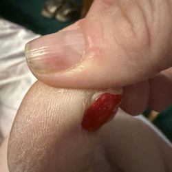 A2Z Nails - Dry skin and not enough polish.