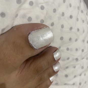 Miami Nail Bar - Glue on my big toe - Nail Salons Near Me - Miami, Florida Miami Nail Bar - Glue on my big toe - Nail Salons Near Me - Miami, Florida