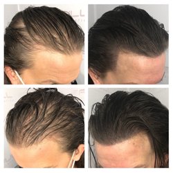 Full Micropigmentation