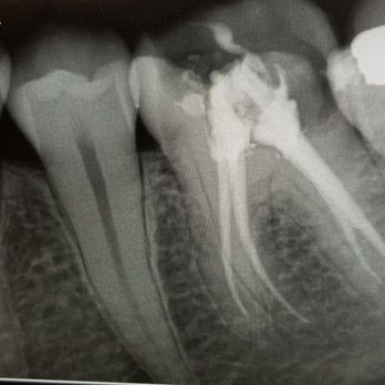 Citadel Dental - Oral Surgeons Near Me - Lincoln, California Citadel Dental - Oral Surgeons Near Me - Lincoln, California