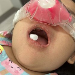 Milktooth Pediatric Dentistry - A crown