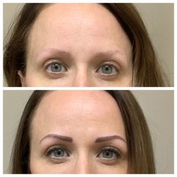 Eyebrows before and after microblading Eyebrows before and after microblading