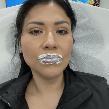 The Plastics Doc & Med Spa - Lip Filler - Plastic Surgeons Near Me - Corona, California The Plastics Doc & Med Spa - Lip Filler - Plastic Surgeons Near Me - Corona, California