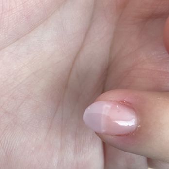 Organic Nails & Spa - Cuts on both side of finger from technicians own nail and file. - Nail Salons Near Me - Bakersfield, California Organic Nails & Spa - Cuts on both side of finger from technicians own nail and file. - Nail Salons Near Me - Bakersfield, California