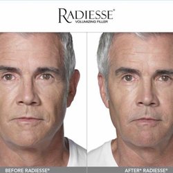 Integra Innova - Cambio de mensaje facial en hombres!