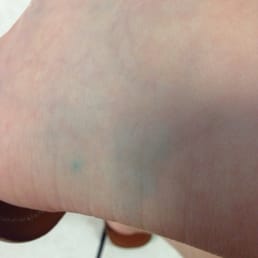 Rock salt residue that looks like I have a bruised ankle