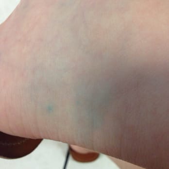 VIP Lao Nails - Rock salt residue that looks like I have a bruised ankle - Nail Salons Near Me - Miami, Florida