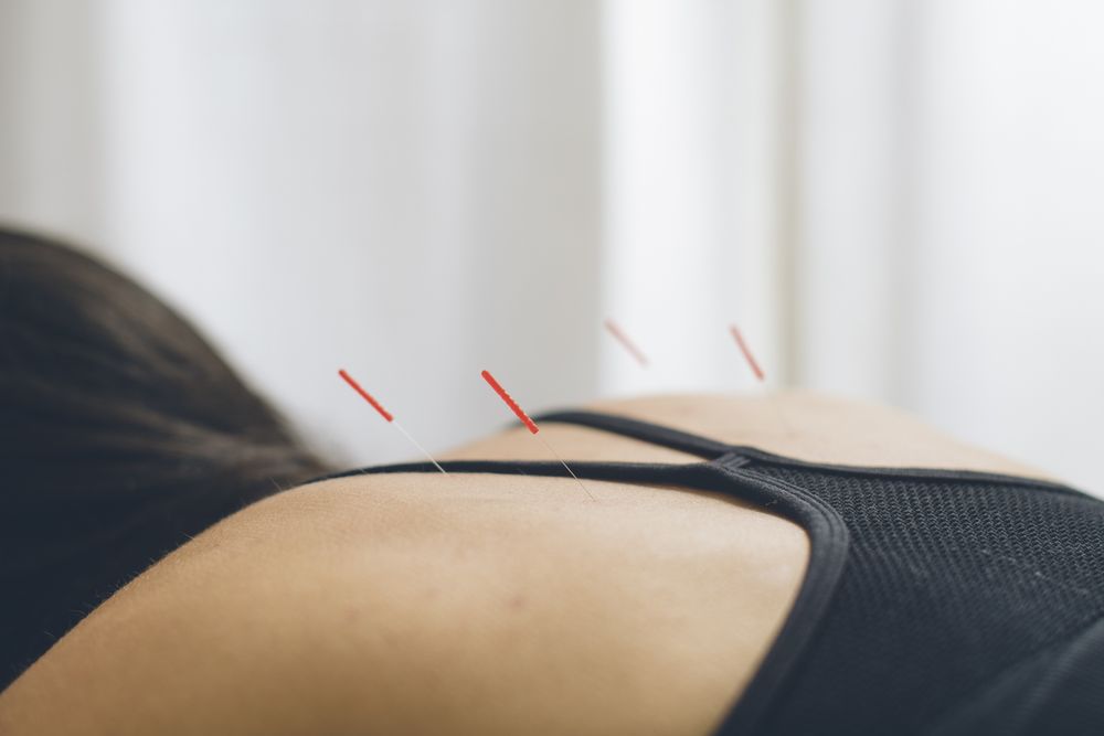 Cindi Ignatovsky, DACM LAc - grief counselor in Campbell, CA