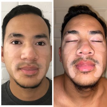 Blooming Beauty - Before and after procedure - Eyebrow Services Near Me - Orlando, Florida
