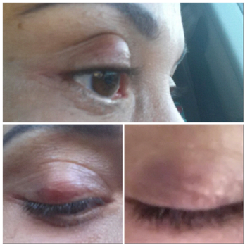 Lake Nona Ophthalmology - Medical Spas Near Me - Orlando, Florida Lake Nona Ophthalmology - Medical Spas Near Me - Orlando, Florida