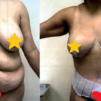 Kimberly Henry, MD - Breast Augmentation and Tummy Tuck - Cosmetic Surgeons Near Me - Greenbrae, California Kimberly Henry, MD - Breast Augmentation and Tummy Tuck - Cosmetic Surgeons Near Me - Greenbrae, California