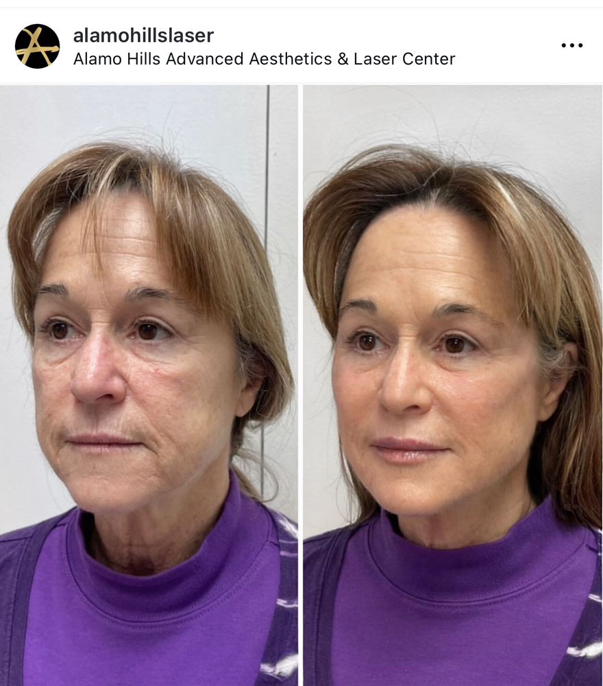 Alamo Hills Advanced Aesthetics and Laser Center