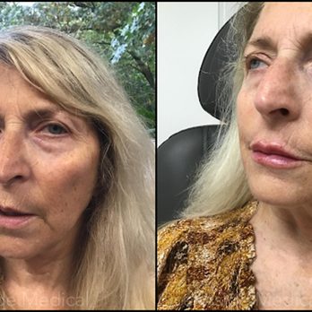 Oceanside Medical - Skin Care Near Me - Warwick, Rhode Island Oceanside Medical - Skin Care Near Me - Warwick, Rhode Island