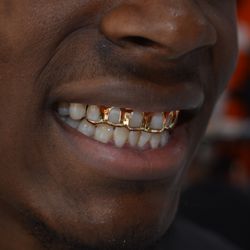 Baltimore Gold Fronts - Customer.