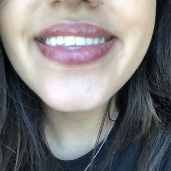 D & E Aesthetics - Day Spas Near Me - San Jose, California